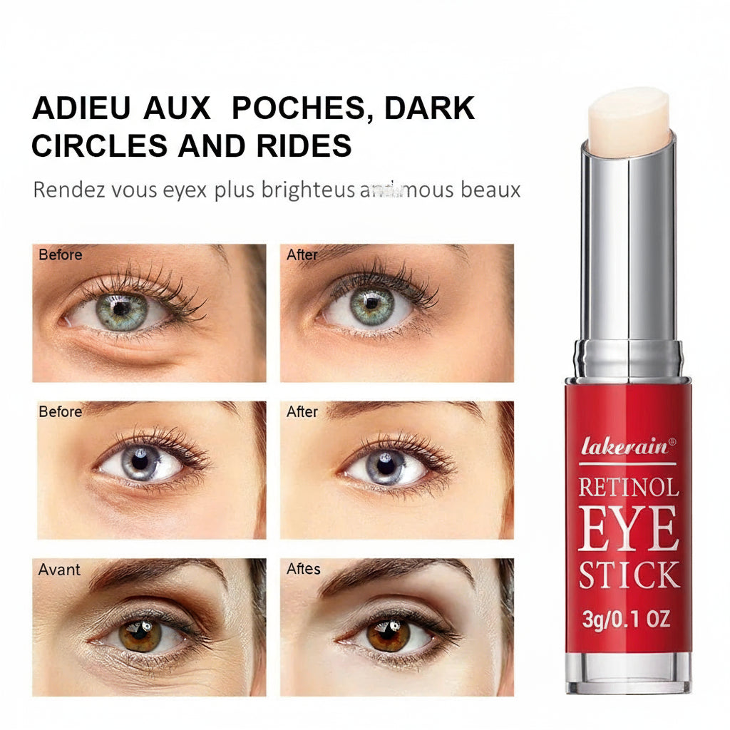 Serum Stick fRetinol Eye Cream Lightening Dark Circles Firming Skin Instant Eye Repairor women Women Eyes Care