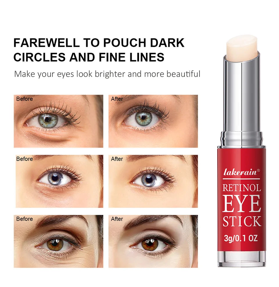 Serum Stick fRetinol Eye Cream Lightening Dark Circles Firming Skin Instant Eye Repairor women Women Eyes Care
